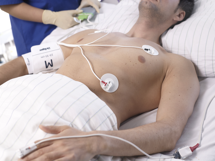 Dräger ECG Cable 3-Lead, Single-Patient Use, IEC, 1 m
