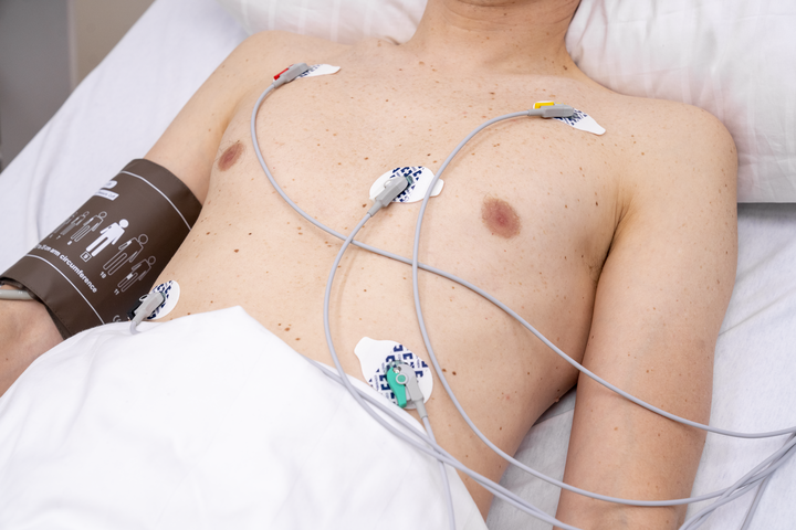 Dräger ECG Limb Lead Wires, 5-Lead, IEC