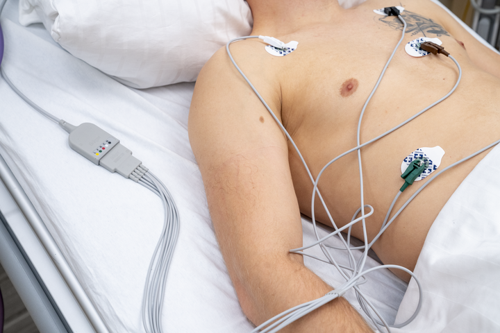 Dräger Defibrillation-Proof ECG Trunk Cable, 3/5-Lead, 2.5 m