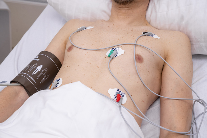 Dräger ECG Limb Lead Wires, 5-Lead, AHA